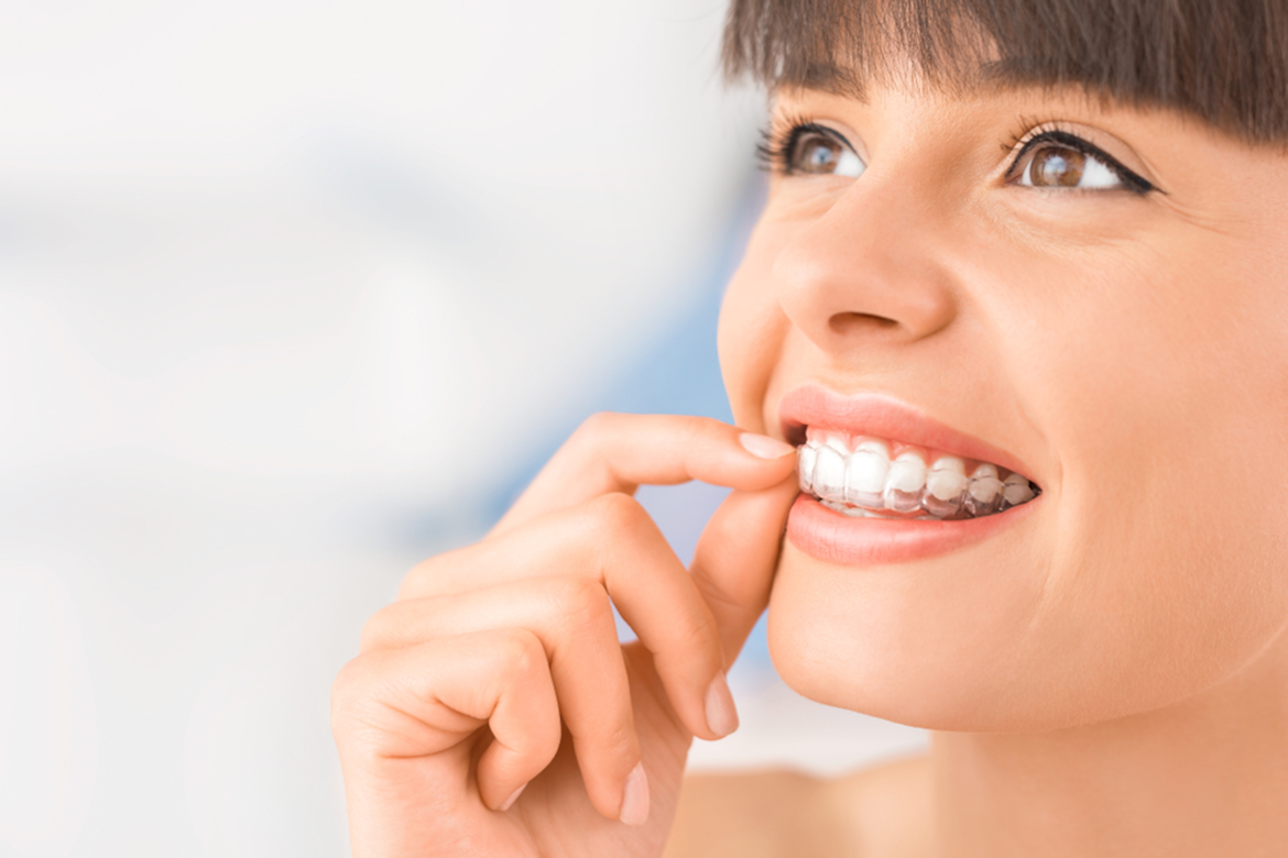 Invisalign in Toronto Beaches