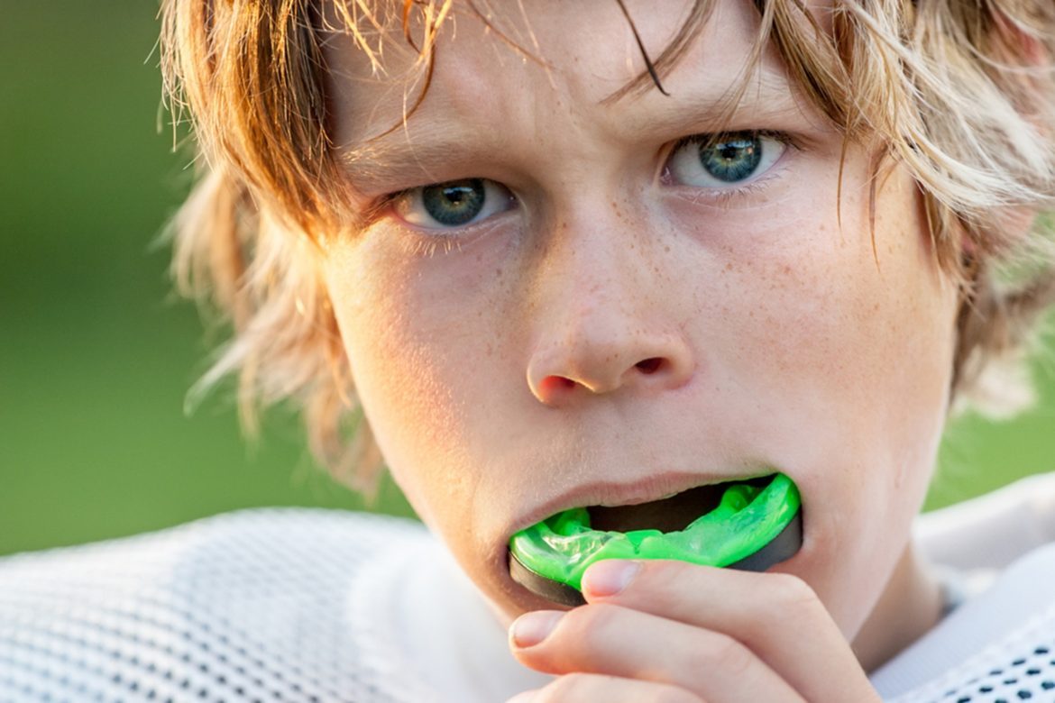 how do mouthguards affect sports performance