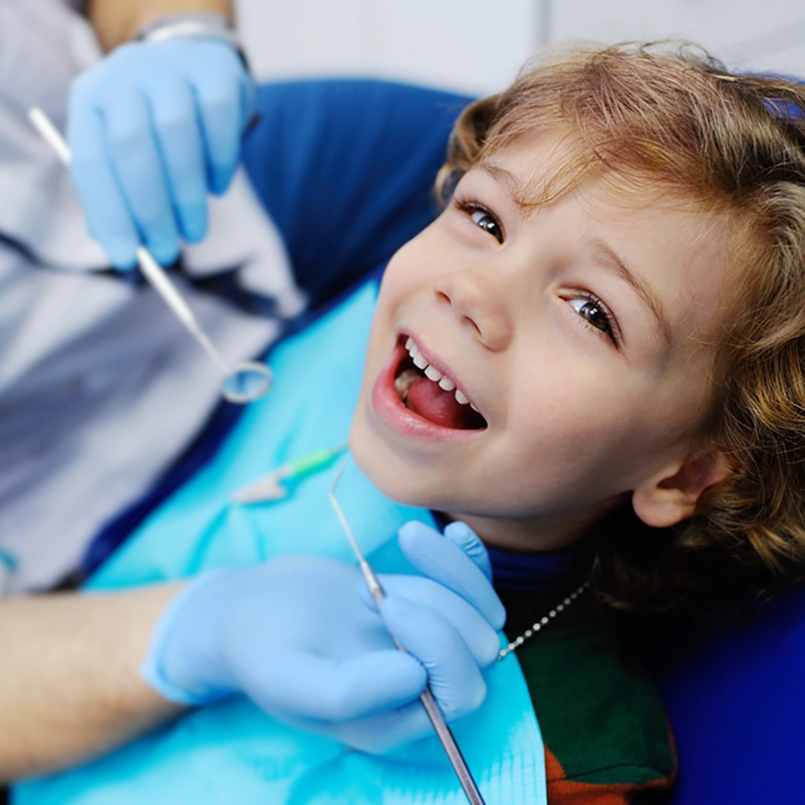 interesting-facts-about-dental-sealants